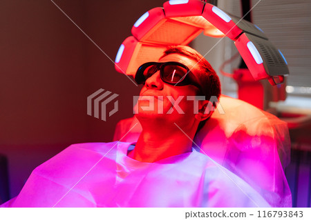 Male patient with hairloss problem in protective goggles having LED light hair photodynamic therapy treatment after hair transplant at clinic. Man client having non-invasive type of phototherapy. Male patient with hairloss problem in protective goggles having LED light hair photodynamic therapy treatment after hair transplant at clinic. Man client having non-invasive type of phototherapy. 116793843