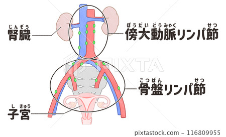 骨盆腔淋巴結和主動脈旁淋巴結的人體解剖圖 簡單易懂的日文插圖 骨盆腔淋巴結和主動脈旁淋巴結的人體解剖圖 簡單易懂的日文插圖 116809955