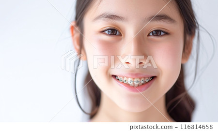 Girl with orthodontic appliance 116814658
