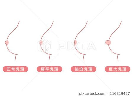 乳頭形狀 乳頭類型 類型 乳頭形狀 乳頭類型 類型 116819437