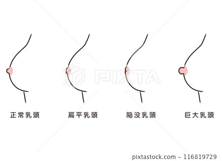 Nipple shape, nipple type, variety 116819729