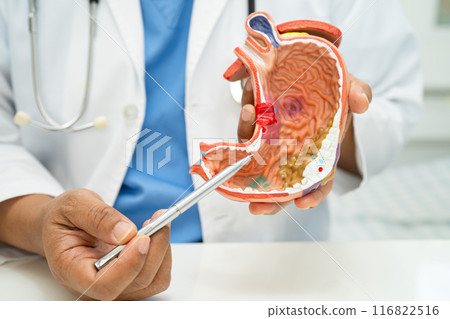 Stomach disease, doctor with human anatomy model for study diagnosis and treatment in hospital. Stomach disease, doctor with human anatomy model for study diagnosis and treatment in hospital. 116822516