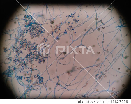 Mold on the refrigerator gasket 116827928