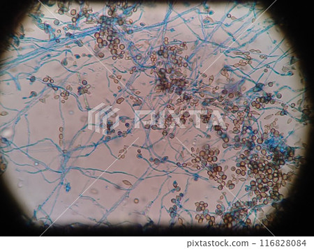 Black mold mycelium and spores growing on refrigerator gasket Black mold mycelium and spores growing on refrigerator gasket 116828084