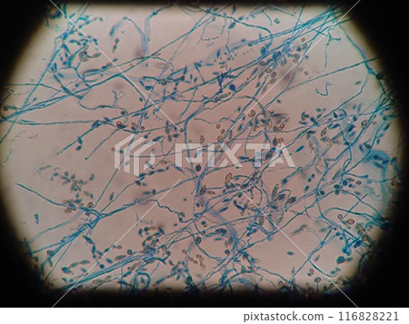 Micrograph of black mold 116828221