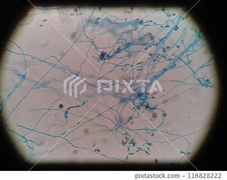 Cross-spreading mold hyphae 116828222