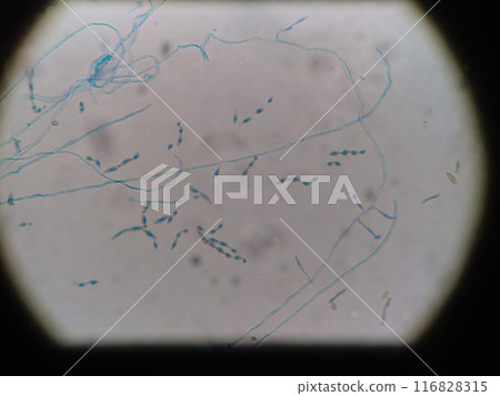 Neatly arranged Alternaria spores Neatly arranged Alternaria spores 116828315