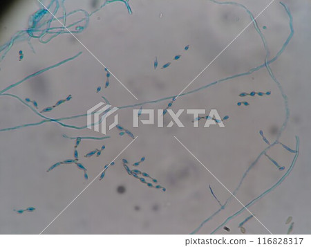 Enlarged micrograph of Alternaria Enlarged micrograph of Alternaria 116828317
