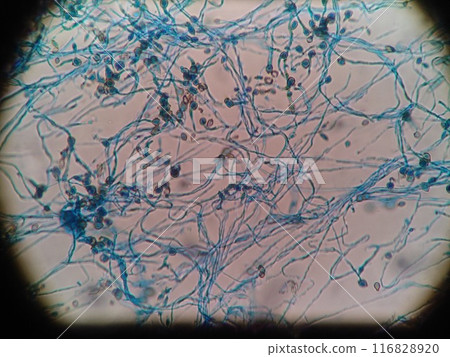 Spores among blue stained hyphae 116828920