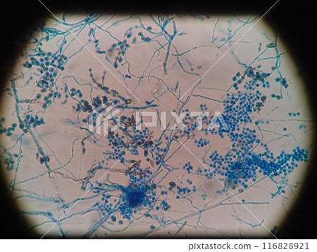 Mold spores popping out 116828921