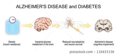 Diabetes and Alzheimers disease Diabetes and Alzheimers disease 116833136