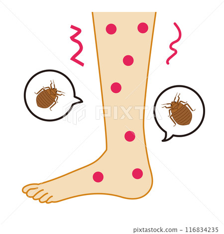Illustration of itchy feet bitten by bedbugs 116834235