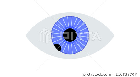 Iris melanoma anatomy 116835707