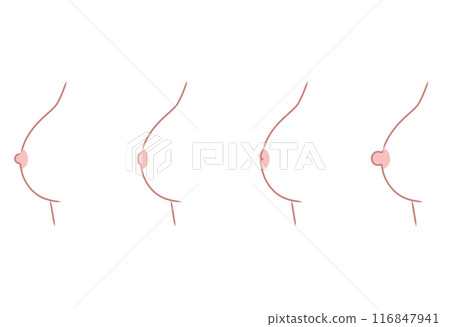 Nipple shape, nipple type, variety 116847941