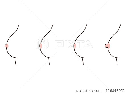 乳頭形狀 乳頭類型 類型 乳頭形狀 乳頭類型 類型 116847951