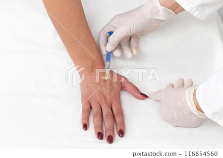 Hand botox Hand botox 116854560