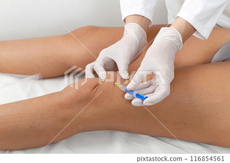 Leg botox Leg botox 116854561