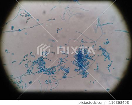 Mold growing on the rubber gasket of a refrigerator Mold growing on the rubber gasket of a refrigerator 116868498