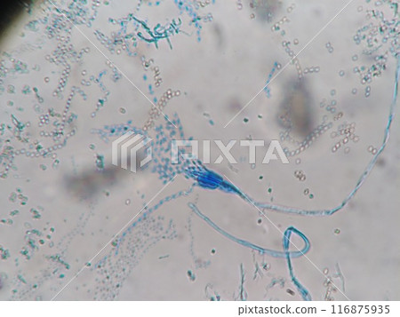 藍色黴菌的顯微照片 藍色黴菌的顯微照片 116875935