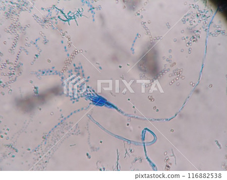 Enlarged photo of Penicillium Enlarged photo of Penicillium 116882538