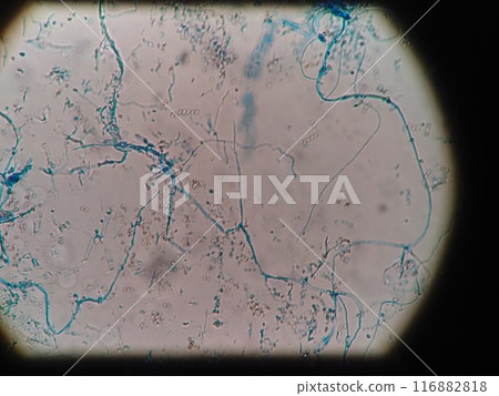 黑色黴菌菌絲在冰箱墊圈上蔓延 黑色黴菌菌絲在冰箱墊圈上蔓延 116882818