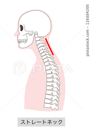 直頸人體骨骼插圖 116884200