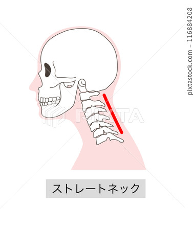 Illustration of the cervical vertebrae and skull of a straight neck 116884208