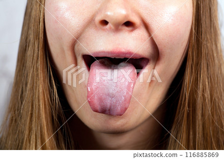 Female tongue. Close-up Of A Woman's Face Showing Her Clean Tongue 116885869