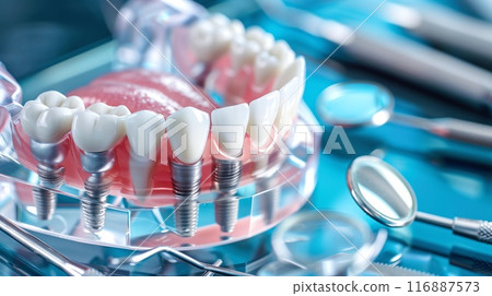 Dental implants 116887573