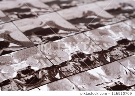 Magnetic resonance imaging of the head of a healthy person, image of the pituitary gland. 116910709