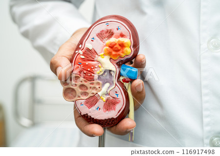 Cardiovascular disease CVD, Asian doctor holding human anatomy model for learn and treat heart disease. 116917498