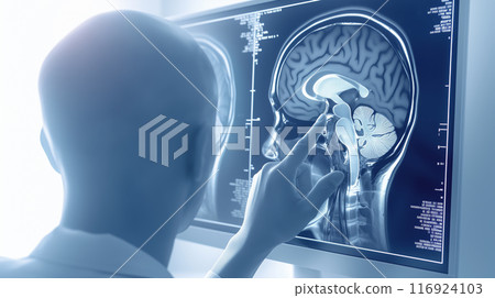 “醫生的視角：醫生檢查大腦 MRI 圖像的背面照片。” 116924103