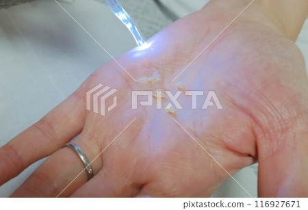 耳朵清潔 耳朵清潔 116927671