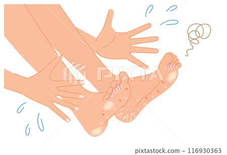 Illustration of a woman surprised by athlete's foot, corns, and calluses on her feet (body parts) Illustration of a woman surprised by athlete's foot, corns, and calluses on her feet (body parts) 116930363