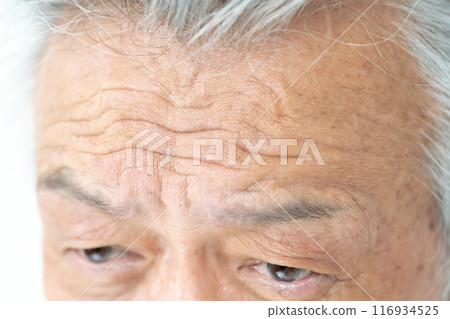 Senior man forehead wrinkles Senior man forehead wrinkles 116934525