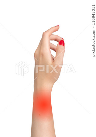 woman's hand showing signs of pain and inflammation, with red areas around the wrist and fingers. woman's hand showing signs of pain and inflammation, with red areas around the wrist and fingers. 116945011