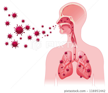 Airborne transmission of the virus Airborne transmission of the virus 116951442