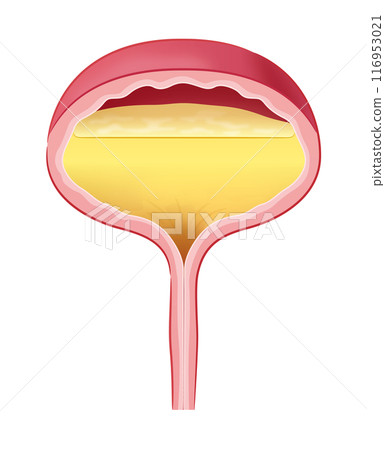 A bladder filled with urine 116953021