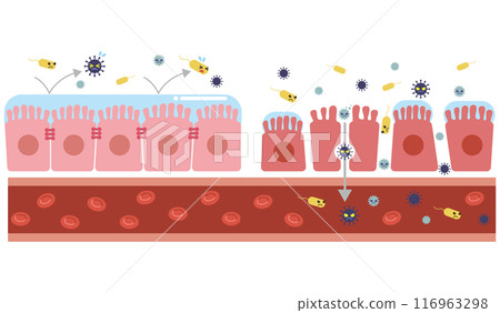 Illustration of leaky gut syndrome (without text) 116963298