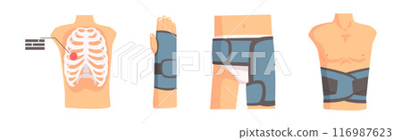 Human Bone and Joint Fracture and Rehabilitation Object Vector Set 116987623