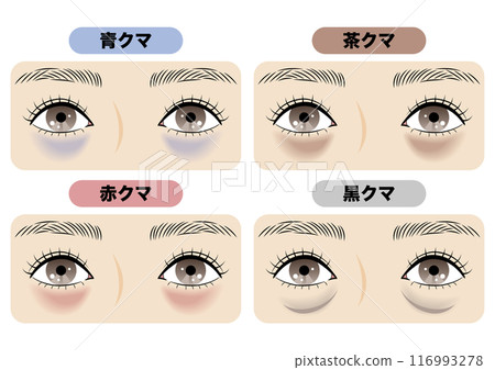 黑眼圈的類型 116993278