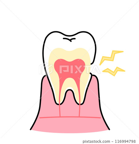 Illustration of exposed dentin, tooth sensitivity, cross-section of tooth Illustration of exposed dentin, tooth sensitivity, cross-section of tooth 116994798