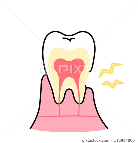 Illustration of receding gums exposing dentin, tooth sensitivity, cross-section of tooth 116994800