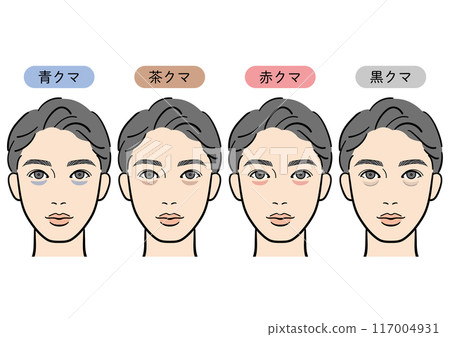 黑眼圈的類型（男性） 117004931