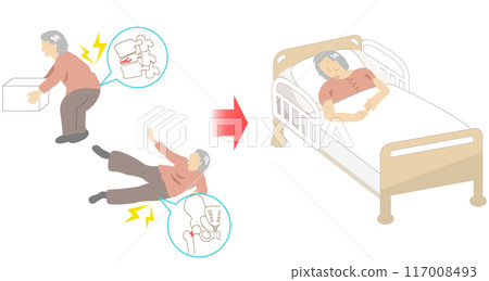 一名老年婦女因骨質疏鬆症而股骨和脊椎骨折,臥床不起。 一名老年婦女因骨質疏鬆症而股骨和脊椎骨折,臥床不起。 117008493