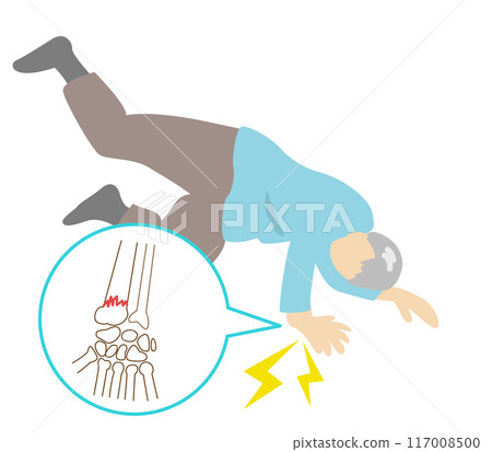 A common site for falls and fractures in elderly people with osteoporosis. Wrist fractures 117008500