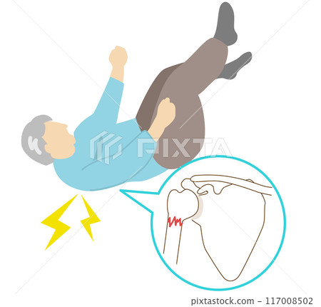 Common site of fracture due to falls in elderly people with osteoporosis. Shoulder fracture 117008502