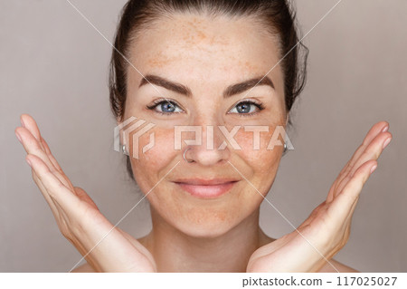 Caucasian woman's face with freckles or age spots, she is smiling and loves her skin close up 117025027