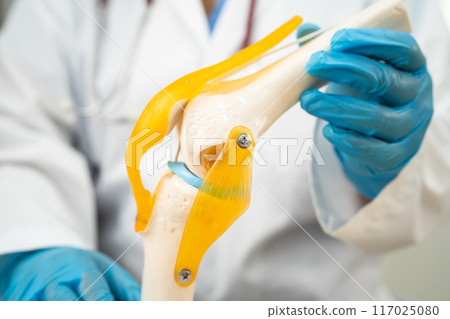Osteoarthritis of the knee, Doctor holding human knee joint orthopedic anatomy model in hospital. 117025080