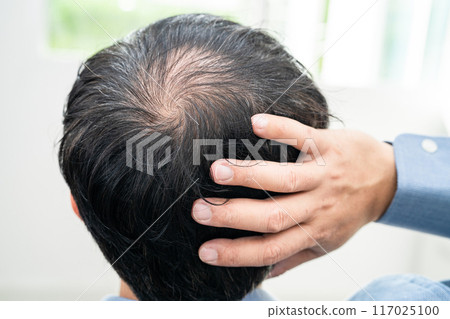 Bald in the middle head and begin no loss hair glabrous of mature Asian business smart active office man. Bald in the middle head and begin no loss hair glabrous of mature Asian business smart active office man. 117025100